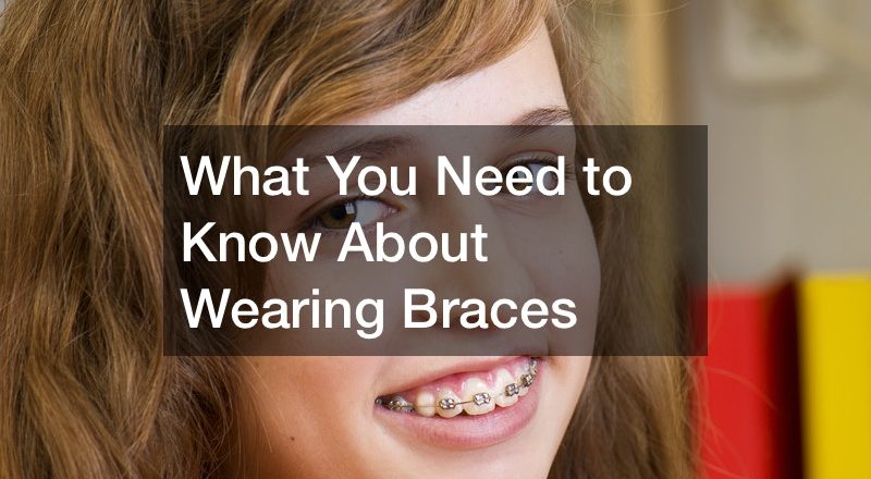 What You Need to Know About Wearing Braces