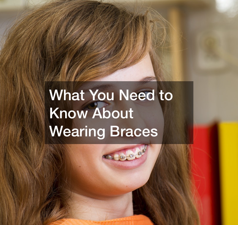 What You Need To Know About Wearing Braces - Daily Inbox