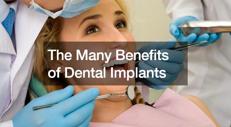 The Many Benefits of Dental Implants