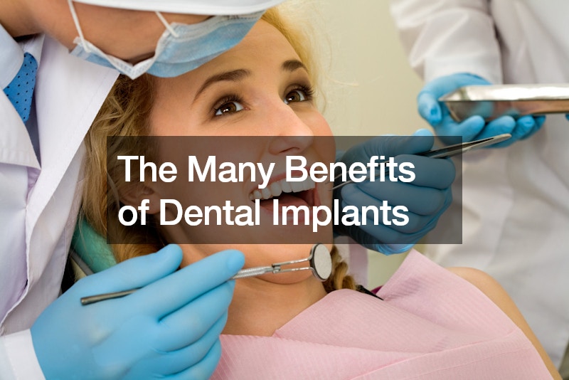 The Many Benefits of Dental Implants