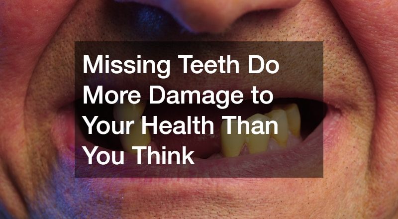 Missing Teeth Do More Damage to Your Health Than You Think