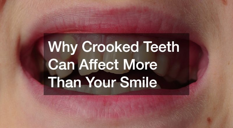 Why Crooked Teeth Can Affect More Than Your Smile